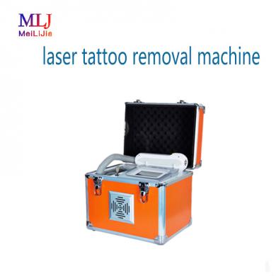 laser tattoo removal machine