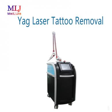 Yag Laser Tattoo Removal