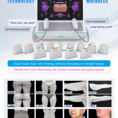 Fusion HIFU Machine